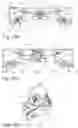 Fig. 23 - Vehicle seat having a backrest