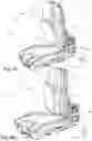 Fig. 15 - Vehicle seat having a backrest