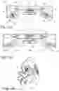 Fig. 23 - Vehicle seat having a backrest