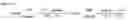 Fig. 07 - METHOD FOR ESTIMATING AND ADJUSTING THE SPEED AND ACCELERATION OF A VEHICLE