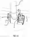 Fig. 12 - PUSH-PULL WAGON