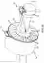 Fig. 04 - Engine mount waiting fail safe detection