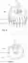Fig. 10 - Safety diffuser lid for an aerosol generator container with depressurization function