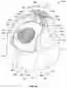 Fig. 32 - Double nozzle overcap assembly