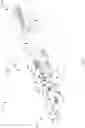 Fig. 02 - Come along device