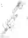 Fig. 03 - Come along device