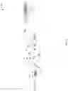 Fig. 04 - Come along device