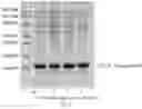 Fig. 16 - METHOD FOR PREPARING TARGET POLYPEPTIDE BY MEANS OF RECOMBINATION AND SERIES CONNECTION OF FUSED PROTEINS
