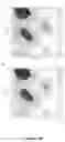 Fig. 16 - DAF-MCP CHIMERIC PROTEINS, PROCESS TO MANUFACTURE THE SAME AND USE OF THE CHIMERIC PROTEIN FOR TREATING PATHOLOGICAL CONDITIONS INVOLVING THE COMPLEMENT SYSTEM