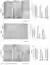 Fig. 16 - ATTENUATION OF BACTERIAL INFECTION