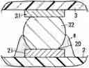 Fig. 01 - Flux resin composition, electronic component, method for manufacturing the electronic component, mounting structure, and method for manufacturing the mounting structure