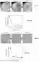 Fig. 04 - Biocompatible Oil Herders and Methods of Use