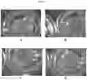 Fig. 12 - Methods for tissue fabrication