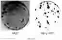 Fig. 17 - COMPOSITION FOR PROMOTING PRODUCTION OF STEM CELL-DERIVED EXOSOMES AND INCREASING STEMNESS