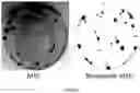 Fig. 24 - COMPOSITION FOR PROMOTING PRODUCTION OF STEM CELL-DERIVED EXOSOMES AND INCREASING STEMNESS