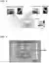 Fig. 04 - MOTILE CELL SORTING DEVICE