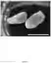 Fig. 10 - COMPOSITIONS, APPARATUSES AND METHODS FOR MAKING AND USING BIOSCAFFOLDS
