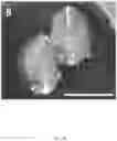 Fig. 11 - COMPOSITIONS, APPARATUSES AND METHODS FOR MAKING AND USING BIOSCAFFOLDS