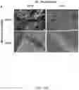 Fig. 20 - COMPOSITIONS, APPARATUSES AND METHODS FOR MAKING AND USING BIOSCAFFOLDS