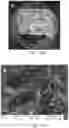 Fig. 22 - COMPOSITIONS, APPARATUSES AND METHODS FOR MAKING AND USING BIOSCAFFOLDS