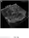 Fig. 42 - COMPOSITIONS, APPARATUSES AND METHODS FOR MAKING AND USING BIOSCAFFOLDS