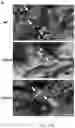 Fig. 46 - COMPOSITIONS, APPARATUSES AND METHODS FOR MAKING AND USING BIOSCAFFOLDS