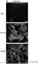 Fig. 47 - COMPOSITIONS, APPARATUSES AND METHODS FOR MAKING AND USING BIOSCAFFOLDS