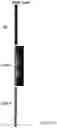 Fig. 48 - COMPOSITIONS, APPARATUSES AND METHODS FOR MAKING AND USING BIOSCAFFOLDS