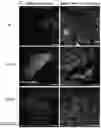 Fig. 54 - COMPOSITIONS, APPARATUSES AND METHODS FOR MAKING AND USING BIOSCAFFOLDS