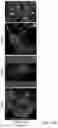 Fig. 55 - COMPOSITIONS, APPARATUSES AND METHODS FOR MAKING AND USING BIOSCAFFOLDS