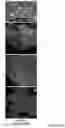 Fig. 56 - COMPOSITIONS, APPARATUSES AND METHODS FOR MAKING AND USING BIOSCAFFOLDS
