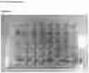 Fig. 21 - METHODS, KITS AND APPARATUS FOR EXPANDING A POPULATION OF CELLS