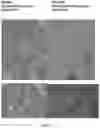 Fig. 02 - PLATELET-RICH PLASMA COMPOSITIONS AND METHODS OF PREPARATION