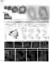 Fig. 02 - PHYSIOLOGIC GROWTH OF CULTURED INTESTINAL TISSUE