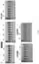 Fig. 08 - CRISPR/CAS-BASED GENOME EDITING COMPOSITION FOR RESTORING DYSTROPHIN FUNCTION
