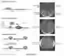 Fig. 04 - CONTINUOUS DIRECTED EVOLUTION