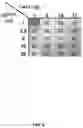 Fig. 11 - CHEMICALLY MODIFIED GUIDE RNAS FOR CRISPR/CAS-MEDIATED GENE CORRECTION