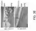 Fig. 09 - OLIGONUCLEOTIDES AND METHODS FOR THE TREATMENT OF AGE-RELATED MACULAR
DEGENERATION