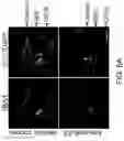 Fig. 16 - OLIGONUCLEOTIDES AND METHODS FOR THE TREATMENT OF AGE-RELATED MACULAR
DEGENERATION
