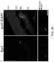 Fig. 19 - OLIGONUCLEOTIDES AND METHODS FOR THE TREATMENT OF AGE-RELATED MACULAR
DEGENERATION