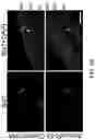 Fig. 20 - OLIGONUCLEOTIDES AND METHODS FOR THE TREATMENT OF AGE-RELATED MACULAR
DEGENERATION