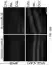 Fig. 28 - OLIGONUCLEOTIDES AND METHODS FOR THE TREATMENT OF AGE-RELATED MACULAR
DEGENERATION