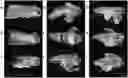Fig. 01 - Antisense oligonucleotide and double stranded RNAS for control of hemipteran and lepidopteran pests