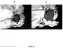 Fig. 07 - Antisense oligonucleotide and double stranded RNAS for control of hemipteran and lepidopteran pests