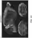 Fig. 12 - INTERNEURON-SPECIFIC THERAPEUTICS FOR NORMALIZING NEURONAL CELL EXCITABILITY AND TREATING DRAVET SYNDROME
