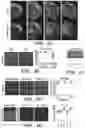 Fig. 18 - INTERNEURON-SPECIFIC THERAPEUTICS FOR NORMALIZING NEURONAL CELL EXCITABILITY AND TREATING DRAVET SYNDROME