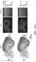 Fig. 40 - INTERNEURON-SPECIFIC THERAPEUTICS FOR NORMALIZING NEURONAL CELL EXCITABILITY AND TREATING DRAVET SYNDROME