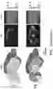Fig. 41 - INTERNEURON-SPECIFIC THERAPEUTICS FOR NORMALIZING NEURONAL CELL EXCITABILITY AND TREATING DRAVET SYNDROME