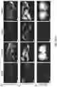 Fig. 07 - ENGINEERED ADENO-ASSOCIATED (AAV) VECTORS FOR TRANSGENE EXPRESSION