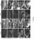 Fig. 09 - ENGINEERED ADENO-ASSOCIATED (AAV) VECTORS FOR TRANSGENE EXPRESSION